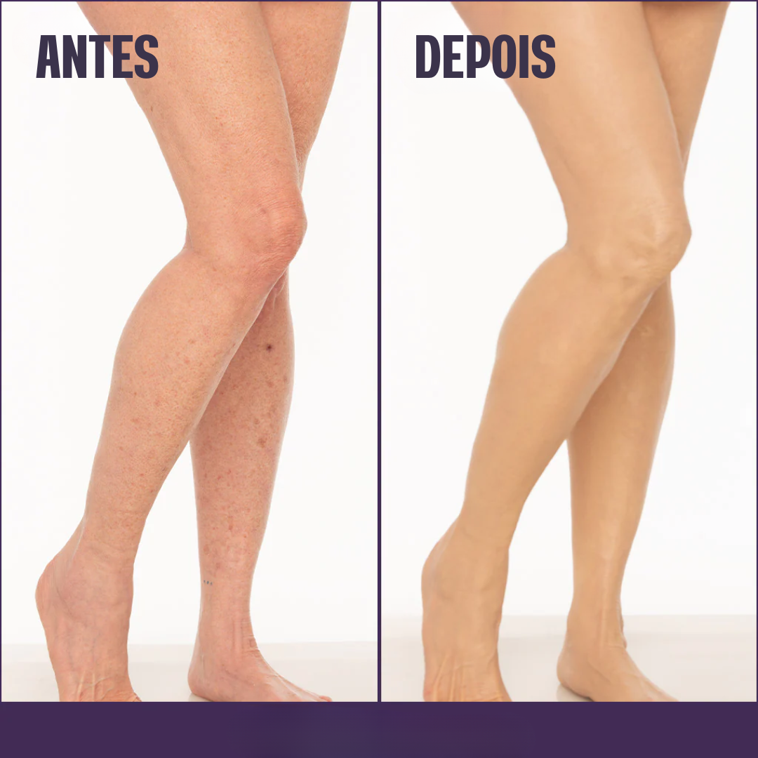 Base Corporal Iluminadora - Remove Manchas✨