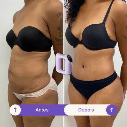 SlimShape - Anel Massageador