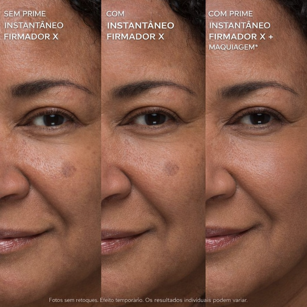 Peter Thom Tensor Facial – Lifting Imediato