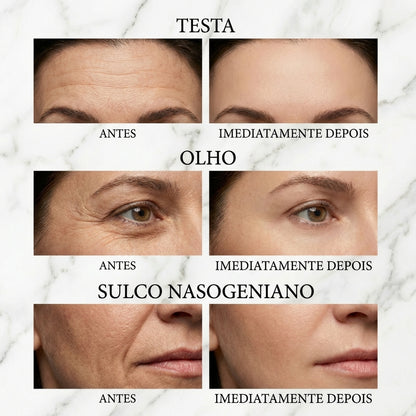 Peter Thom Tensor Facial – Lifting Imediato